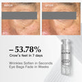 [New Launch] Moritek Ultimate Mori-Lift Depuff Eye Serum｜Skincare, Reduces Wrinkles in 30 Sec, 15 Min Eliminates Eye Bags