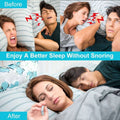 6Pcs Large anti Snoring Dilators, Snore Stopper Device Nose Vents Nasal Dilator Breathing Sleeping Relief