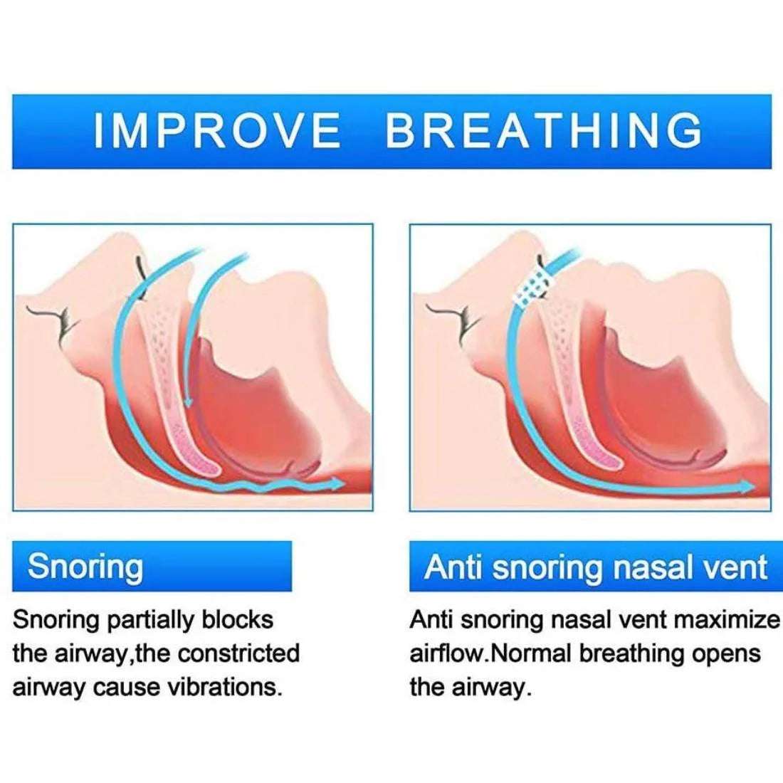 6Pcs Large anti Snoring Dilators, Snore Stopper Device Nose Vents Nasal Dilator Breathing Sleeping Relief