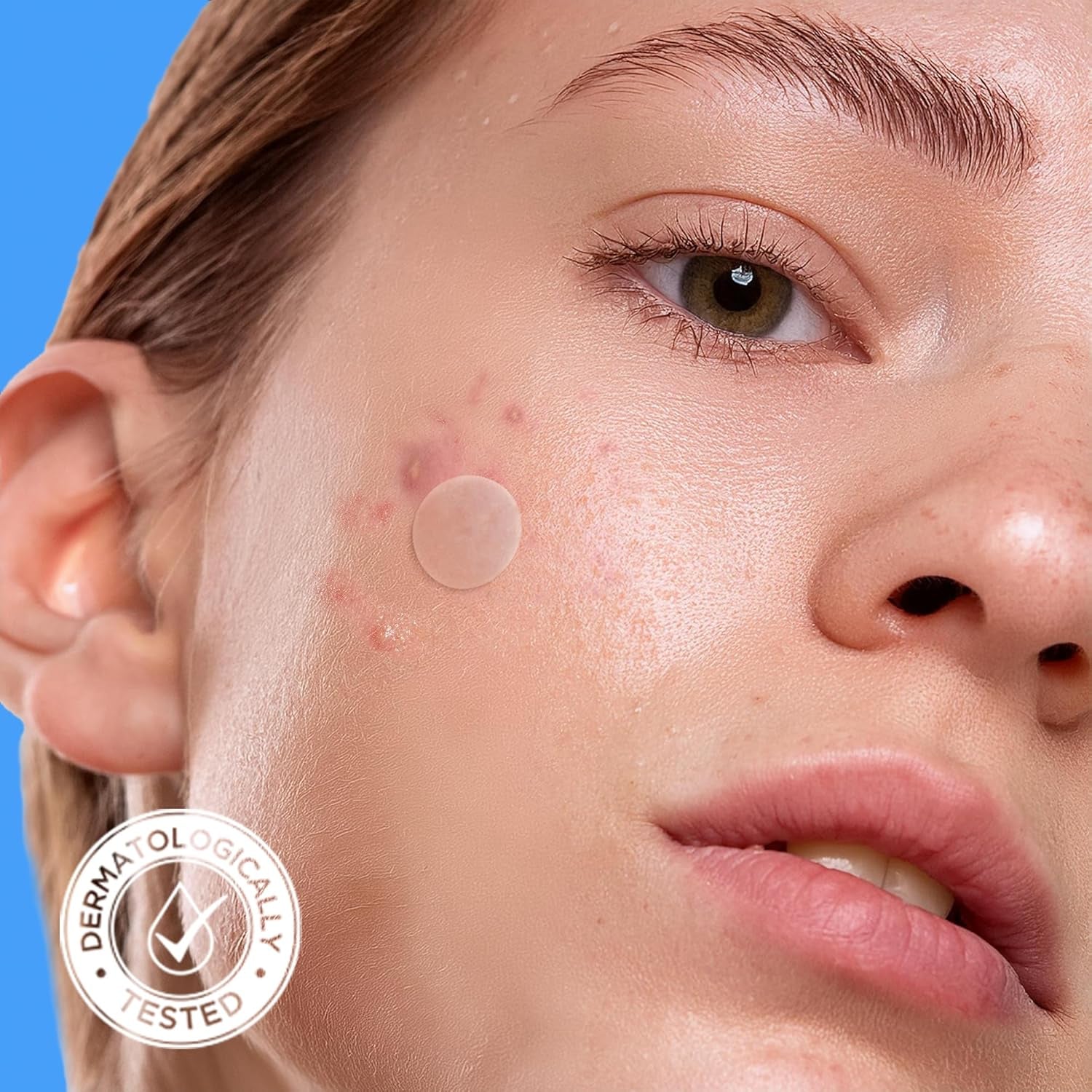 Acne Cover Patches, Eligible Hydrocolloid Pimple Patches for Face with Tea Tree Oil, Korean Skincare Zit Patches for Face | HSA Store Eligible Items | Vegan, Cruelty-Free