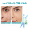 Salicylic Acid Serum for Face with Glycolic Acid, Azelaic Acid, Redness Relief, Hydrating & Smoothing Serum, anti Aging Facial Serum, 30 Ampoules