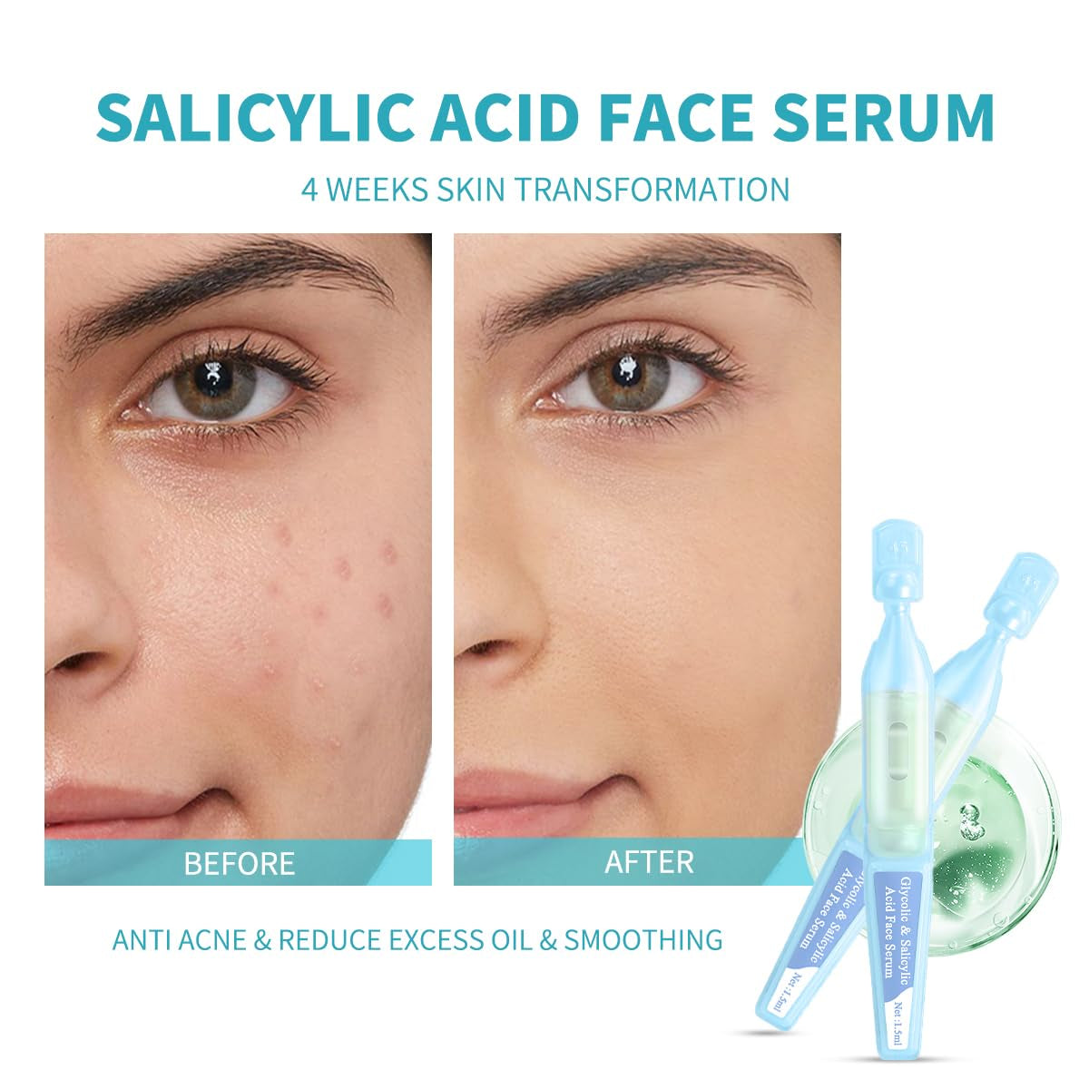 Salicylic Acid Serum for Face with Glycolic Acid, Azelaic Acid, Redness Relief, Hydrating & Smoothing Serum, anti Aging Facial Serum, 30 Ampoules