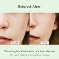 Cica Pore Cleansing Foam 4.05 Fl Oz Sebum Control Hyaluronic Acid Aloe Daily