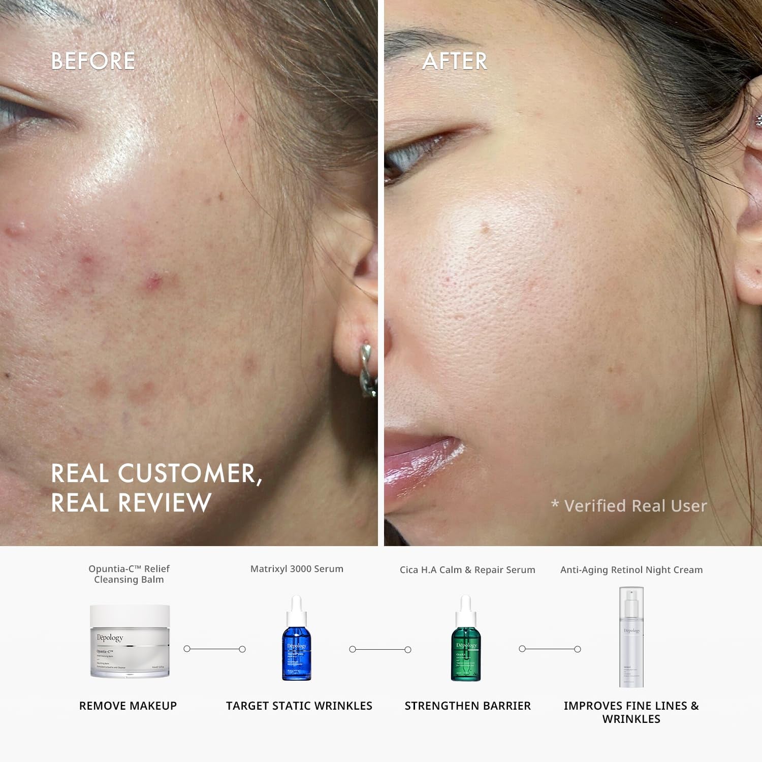 CICA H.A Calm & Repair Serum | Reducing Discomfortable and Sensitivity Face Serum | Hydrating & Replenishing Facial Skin Care Product | Providing Relief from Redness Serum 1.01 Fl.Oz